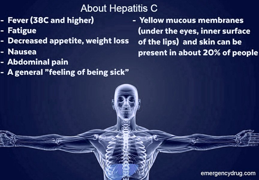 Hepatitis C Symptoms, Causes and Treatment Emergency Drug