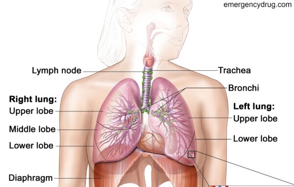 Causes of Lung Cancer part 1