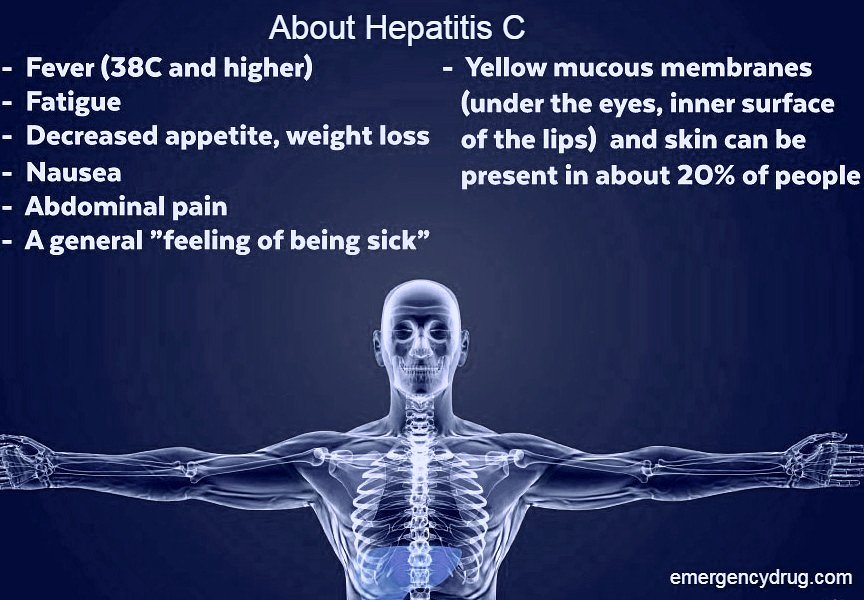 hepatitis c symptoms in men