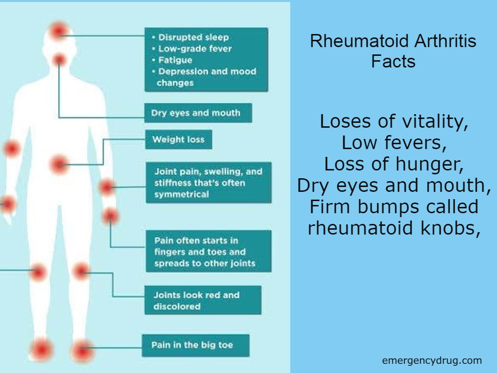 Rheumatoid Arthritis Facts