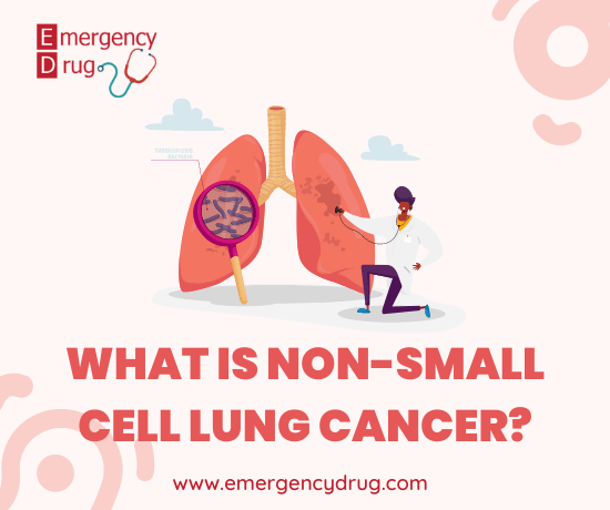 What is Non-small Cell Lung Cancer