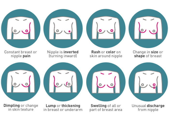 Signs and Symptoms of Breast Cancer