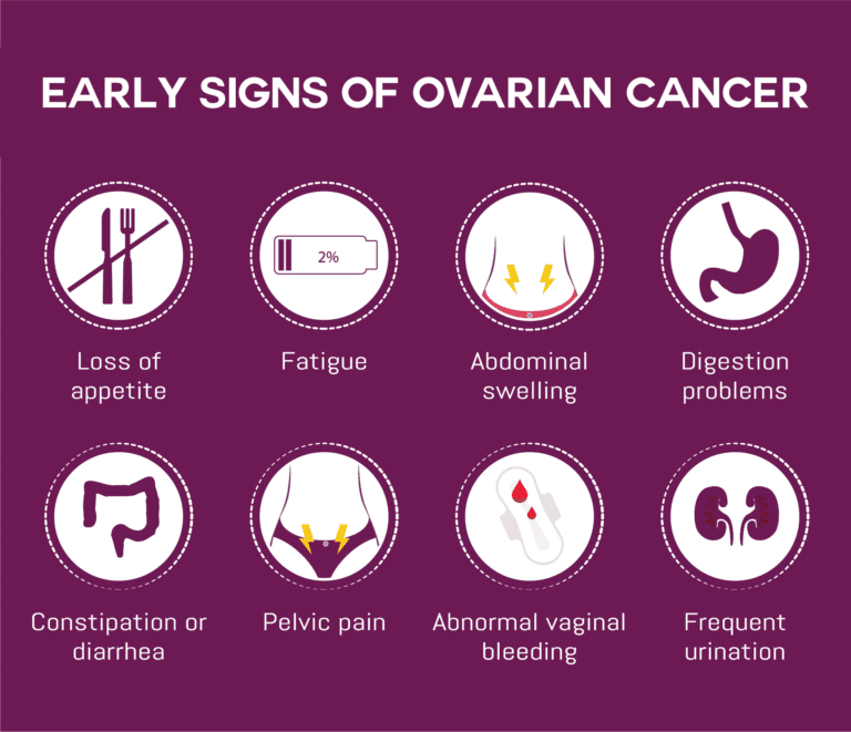 Ovarian Cancer: Early Signs, Detection, and Treatment