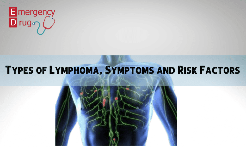 Types Of Lymphoma, Symptoms And Risk Factors