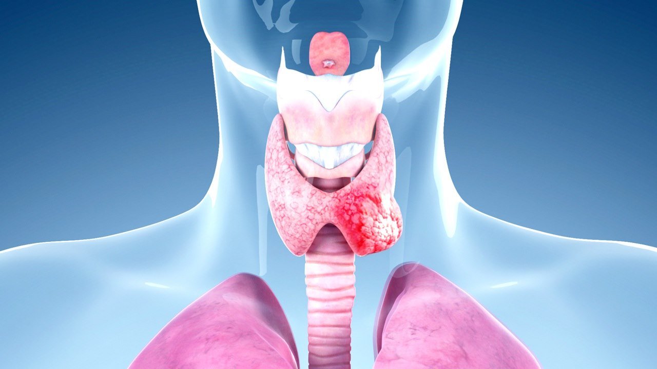 lenvatinib thyroid cancer