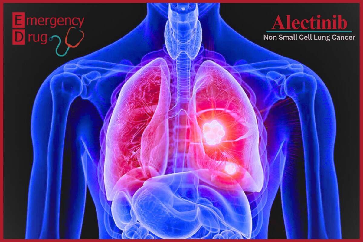 Alectinib is used to treat non-small cell lung cancer (NSCLC).