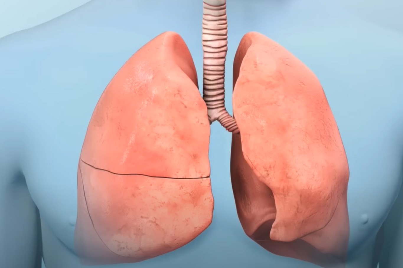 Symptoms of Stage 1 Lung Cancer