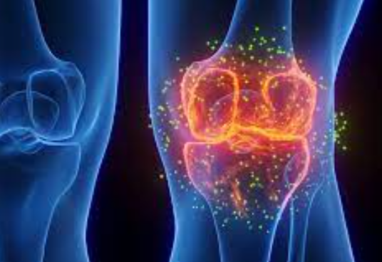 
Rheumatoid-Arthritis-RA