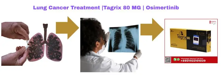 lung-cancer-treatment-tagrix-80-mg-osimertinib
